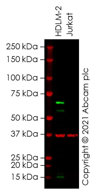 Western blot - Anti-LAG-3 antibody [CAL26] - BSA and Azide free (AB251605)