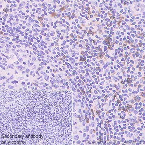 Immunohistochemistry (Formalin/PFA-fixed paraffin-embedded sections) - Anti-LAG-3 antibody [CAL77] (AB237720), expandable thumbnail