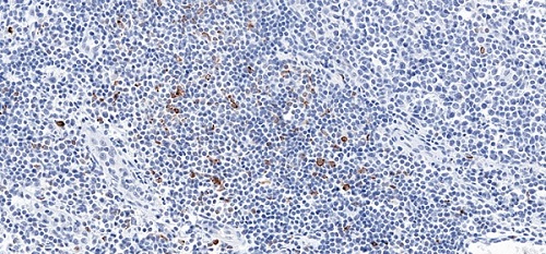 Immunohistochemistry (Formalin/PFA-fixed paraffin-embedded sections) - Anti-LAG-3 antibody [CAL77] (AB237720), expandable thumbnail