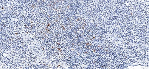 Immunohistochemistry (Formalin/PFA-fixed paraffin-embedded sections) - Anti-LAG-3 antibody [CAL77] (AB237720)