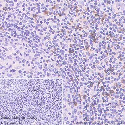 Immunohistochemistry (Formalin/PFA-fixed paraffin-embedded sections) - Anti-LAG-3 antibody [CAL77] (AB237720)