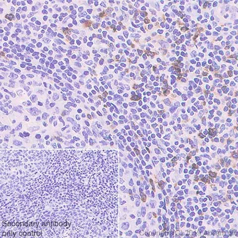 Immunohistochemistry (Formalin/PFA-fixed paraffin-embedded sections) - Anti-LAG-3 antibody [CAL77] - BSA and Azide free (AB251606)