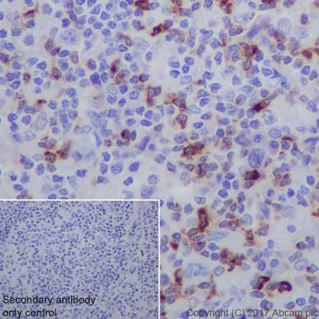 Immunohistochemistry (Formalin/PFA-fixed paraffin-embedded sections) - Anti-LAG-3 antibody [EPR20261] - Low endotoxin, Azide free (ab282638), expandable thumbnail