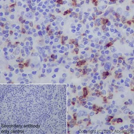 Immunohistochemistry (Formalin/PFA-fixed paraffin-embedded sections) - Anti-LAG-3 antibody [EPR20261] - Low endotoxin, Azide free (AB282638)