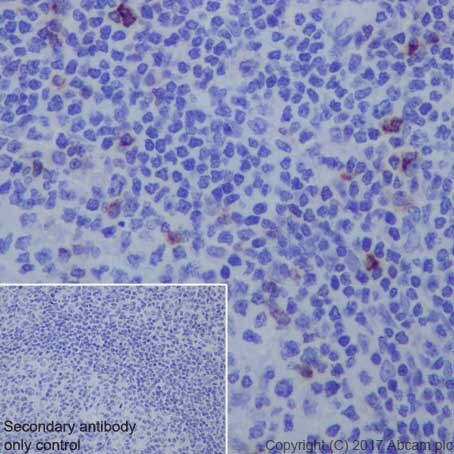 Immunohistochemistry (Formalin/PFA-fixed paraffin-embedded sections) - Anti-LAG-3 antibody [EPR20261] - Low endotoxin, Azide free (AB282638), expandable thumbnail