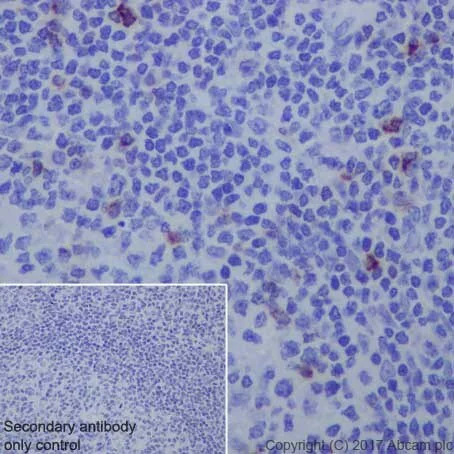 Immunohistochemistry (Formalin/PFA-fixed paraffin-embedded sections) - Anti-LAG-3 antibody [EPR20261] - Low endotoxin, Azide free (AB282638)