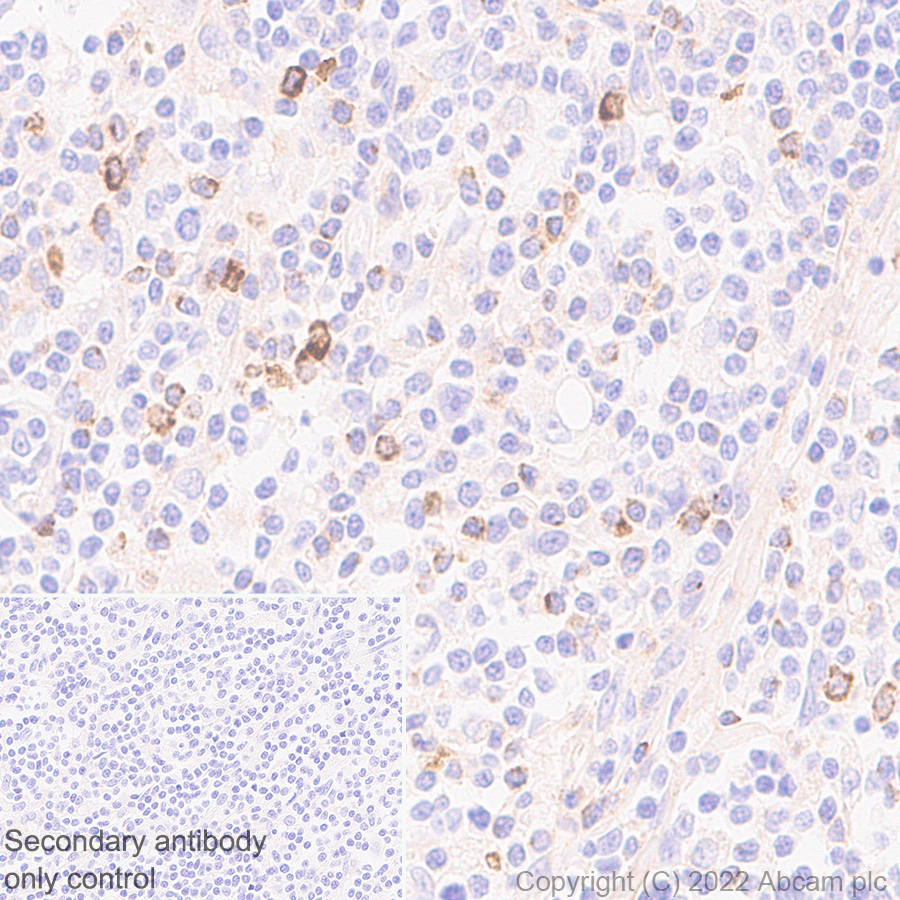 Immunohistochemistry - Anti-LAG-3 antibody [EPR20261] - Mouse IgG1 (Chimeric) - BSA and Azide free (AB307518), expandable thumbnail