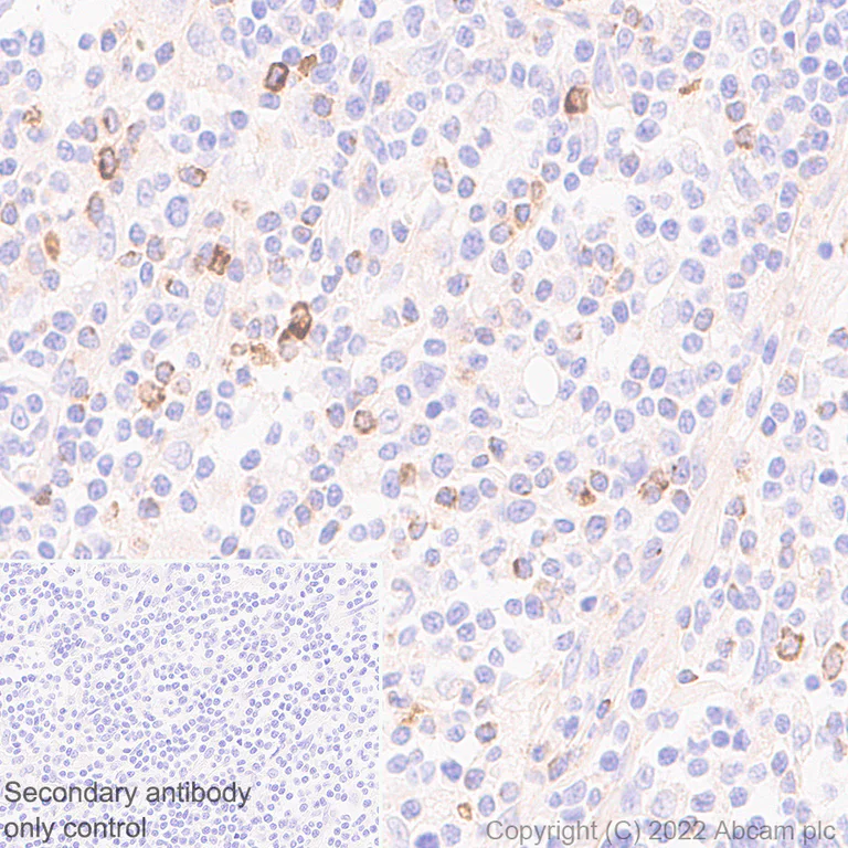 Immunohistochemistry - Anti-LAG-3 antibody [EPR20261] - Mouse IgG1 (Chimeric) - BSA and Azide free (AB307518)