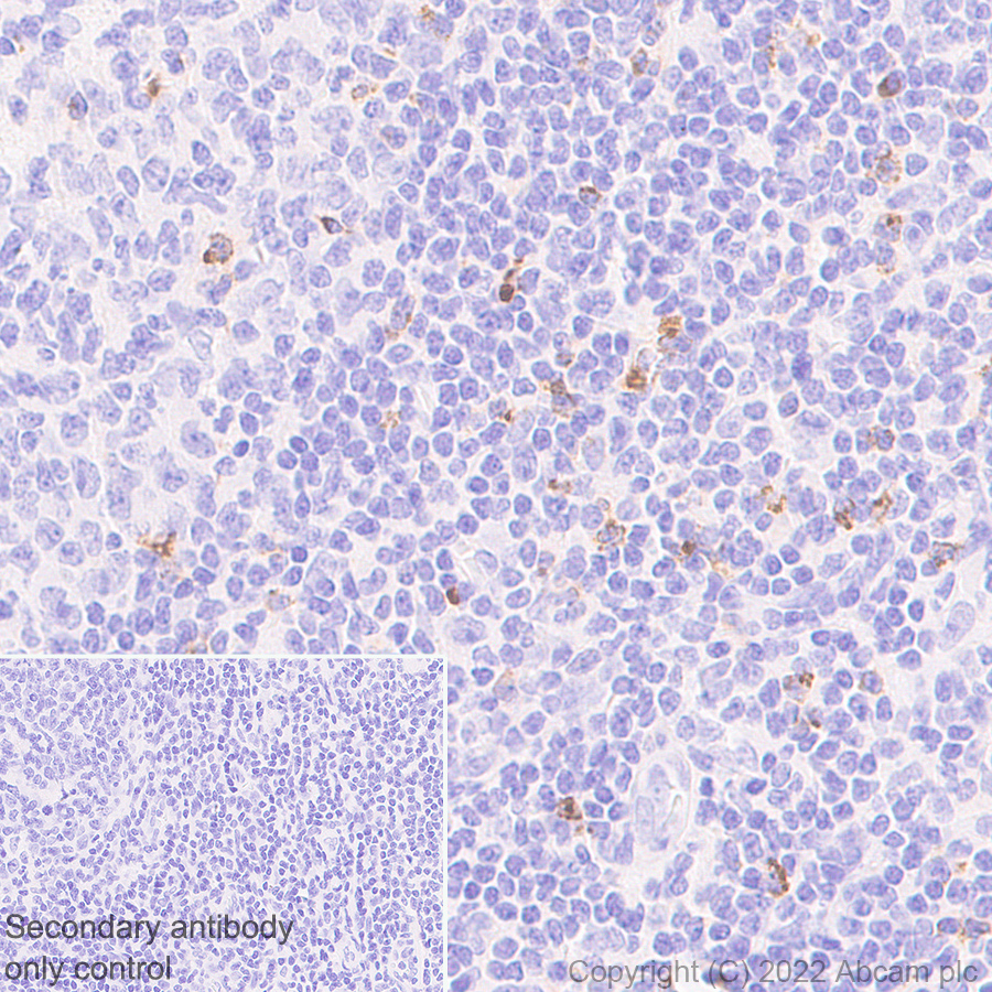 Immunohistochemistry - Anti-LAG-3 antibody [EPR20261] - Mouse IgG1 (Chimeric) - BSA and Azide free (AB307518), expandable thumbnail