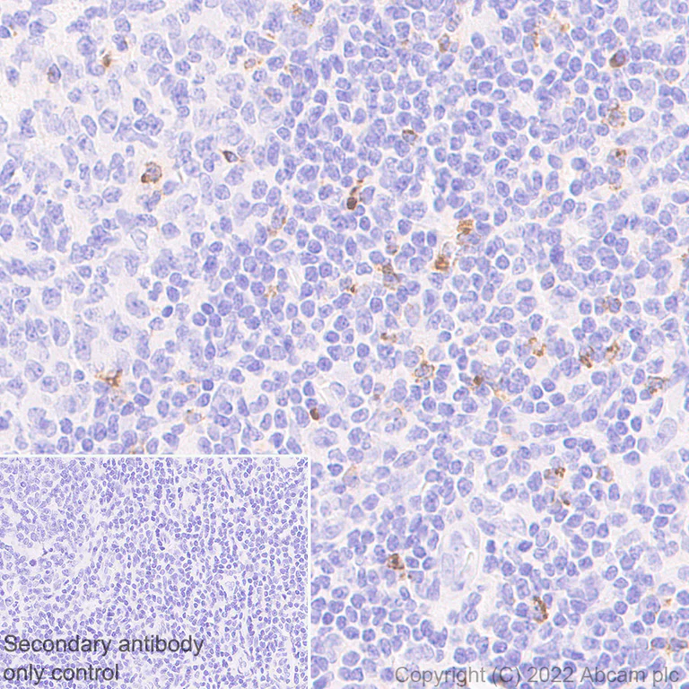 Immunohistochemistry - Anti-LAG-3 antibody [EPR20261] - Mouse IgG1 (Chimeric) - BSA and Azide free (AB307518)