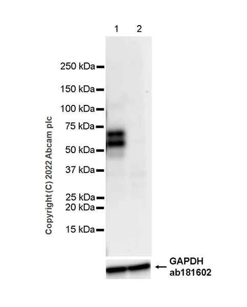Western blot - Anti-LAG-3 antibody [EPR20261] - Mouse IgG1 (Chimeric) - BSA and Azide free (AB307518)