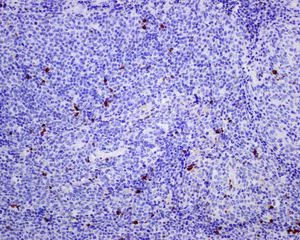 Immunohistochemistry (Formalin/PFA-fixed paraffin-embedded sections) - Anti-LAG-3 antibody [EPR4392(2)] - C-terminal (AB180187)