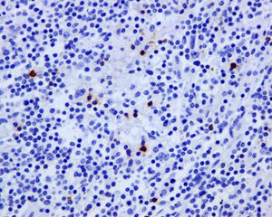 Immunohistochemistry (Formalin/PFA-fixed paraffin-embedded sections) - Anti-LAG-3 antibody [EPR4392(2)] - C-terminal (AB180187), expandable thumbnail