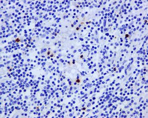 Immunohistochemistry (Formalin/PFA-fixed paraffin-embedded sections) - Anti-LAG-3 antibody [EPR4392(2)] - C-terminal (AB180187)