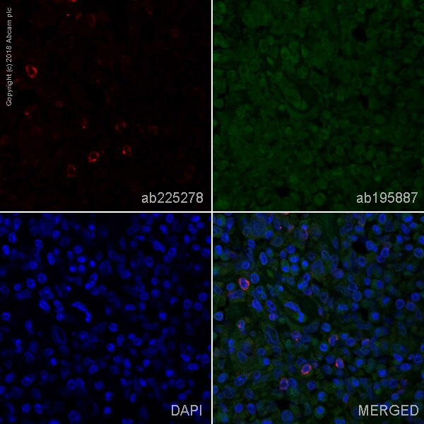 Immunohistochemistry (Formalin/PFA-fixed paraffin-embedded sections) - Anti-LAG-3 antibody [EPR4392(2)] - Low endotoxin, Azide free (AB282642), expandable thumbnail