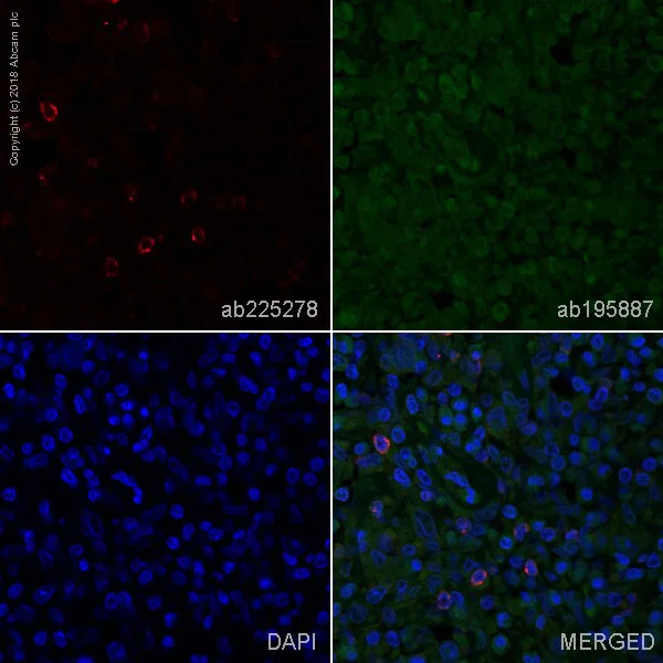 Immunohistochemistry (Formalin/PFA-fixed paraffin-embedded sections) - Anti-LAG-3 antibody [EPR4392(2)] - Low endotoxin, Azide free (AB282642)