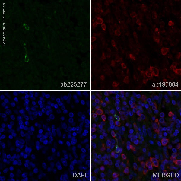 Immunohistochemistry (Formalin/PFA-fixed paraffin-embedded sections) - Anti-LAG-3 antibody [EPR4392(2)] - Low endotoxin, Azide free (AB282642), expandable thumbnail