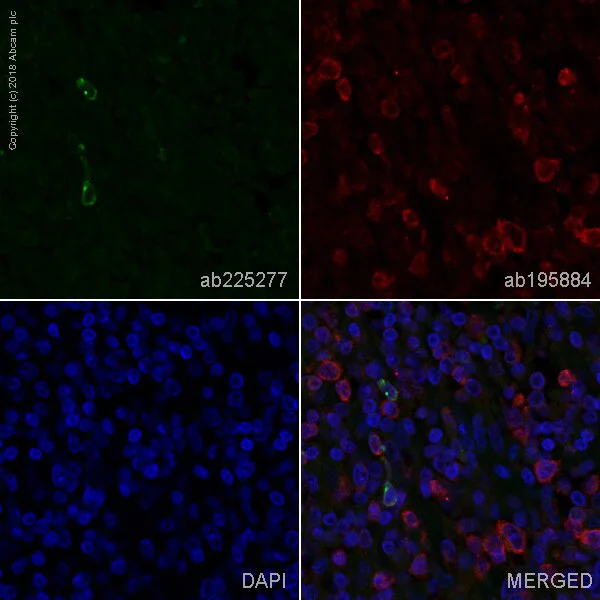 Immunohistochemistry (Formalin/PFA-fixed paraffin-embedded sections) - Anti-LAG-3 antibody [EPR4392(2)] - Low endotoxin, Azide free (AB282642)