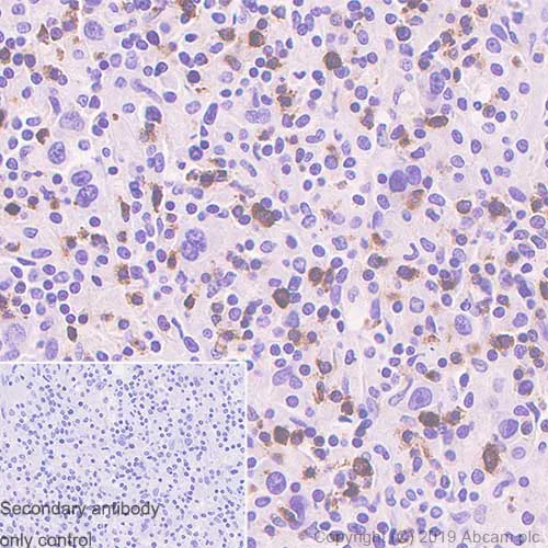 Immunohistochemistry (Formalin/PFA-fixed paraffin-embedded sections) - LAG-3 Antibody Panel (EPR20261, EPR4392(2), SP346, CAL77, CAL25, CAL26) (AB252193)