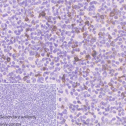 Immunohistochemistry (Formalin/PFA-fixed paraffin-embedded sections) - LAG-3 Antibody Panel (EPR20261, EPR4392(2), SP346, CAL77, CAL25, CAL26) (AB252193)