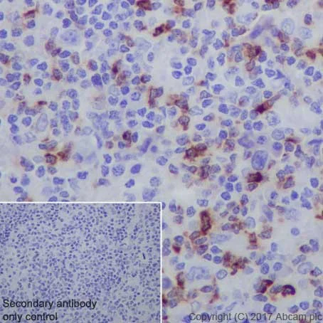 Immunohistochemistry (Formalin/PFA-fixed paraffin-embedded sections) - LAG-3 Antibody Panel (EPR20261, EPR4392(2), SP346, CAL77, CAL25, CAL26) (AB252193)