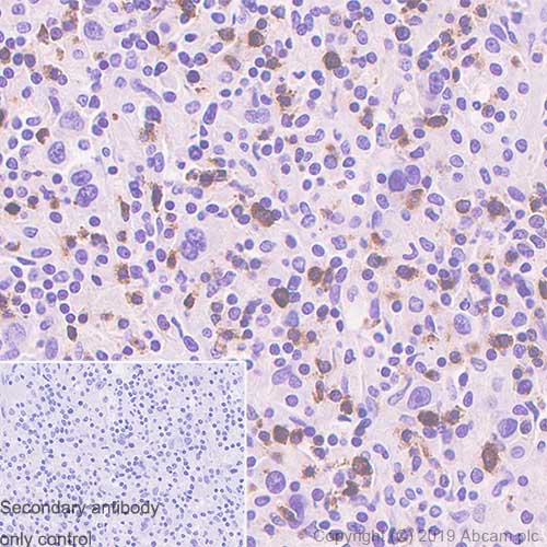 Immunohistochemistry (Formalin/PFA-fixed paraffin-embedded sections) - Anti-LAG-3 antibody [SP346] - BSA and Azide free (AB241407), expandable thumbnail