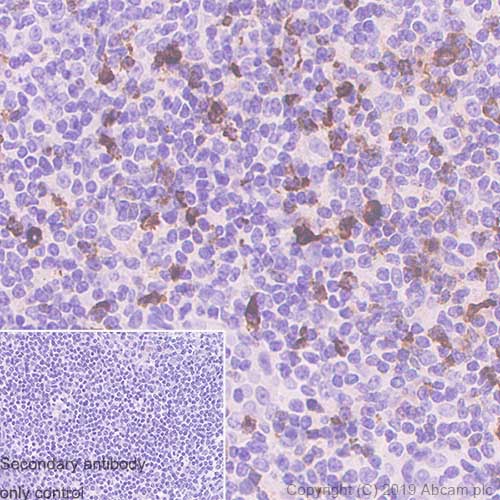 Immunohistochemistry (Formalin/PFA-fixed paraffin-embedded sections) - Anti-LAG-3 antibody [SP346] - BSA and Azide free (AB241407), expandable thumbnail