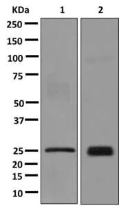 Western blot - Anti-LAGE-1 antibody [EPR12527] - BSA and Azide free (AB250018)