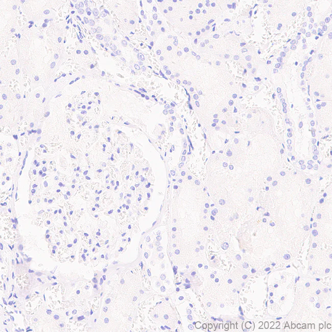 Immunohistochemistry (Formalin/PFA-fixed paraffin-embedded sections) - Anti-LAGE-1 antibody [EPR27371-91] - BSA and Azide free (AB307733)