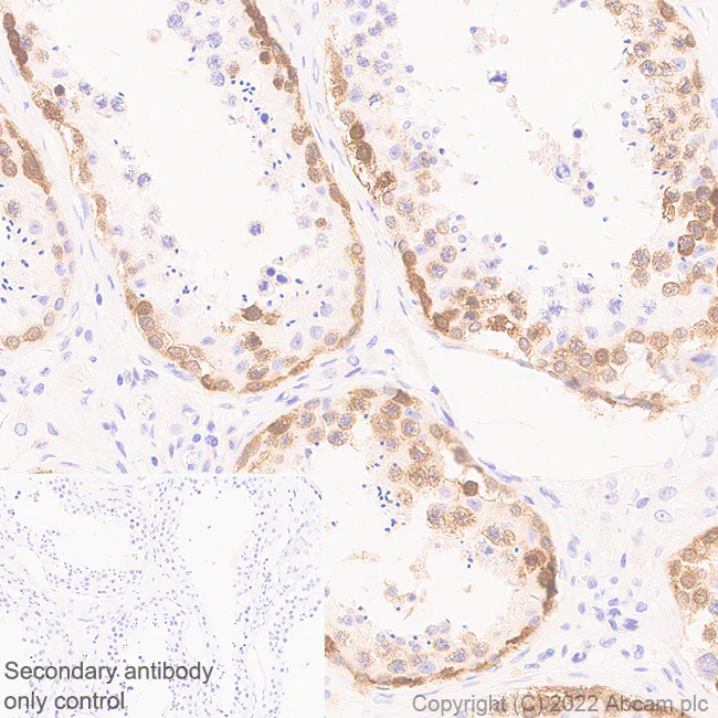 Immunohistochemistry (Formalin/PFA-fixed paraffin-embedded sections) - Anti-LAGE-1 antibody [EPR27371-91] - BSA and Azide free (AB307733)