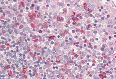 Immunohistochemistry (Formalin/PFA-fixed paraffin-embedded sections) - Anti-LAIR1 antibody (AB189412)