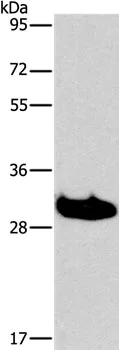 Western blot - Anti-LAIR1 antibody (AB197804)