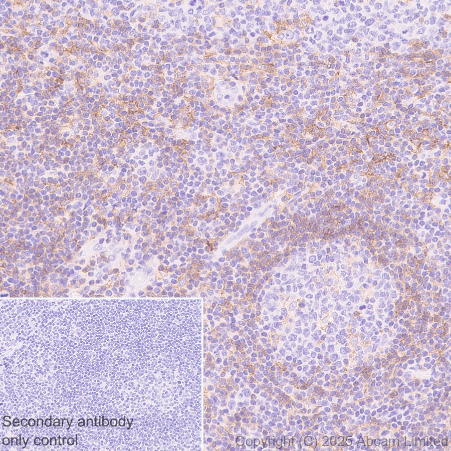 Immunohistochemistry (Formalin/PFA-fixed paraffin-embedded sections) - Anti-LAIR1 antibody [EPR24745-9] (AB323640), expandable thumbnail