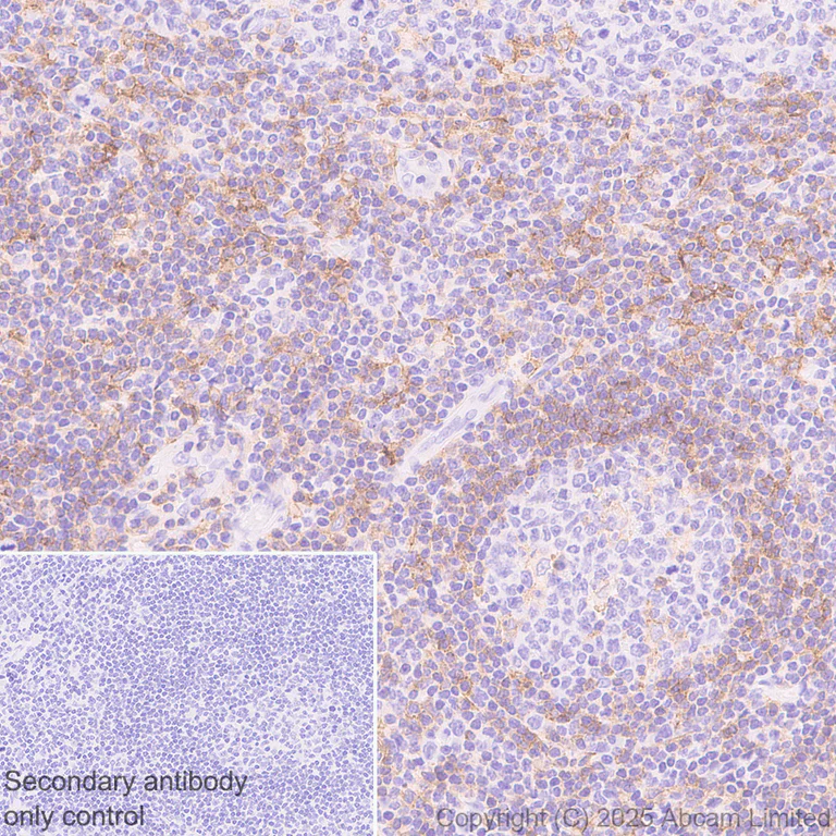 Immunohistochemistry (Formalin/PFA-fixed paraffin-embedded sections) - Anti-LAIR1 antibody [EPR24745-9] (AB323640)