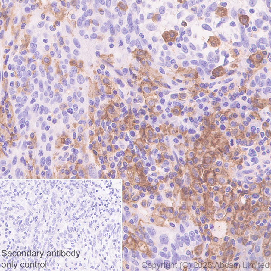 Immunohistochemistry (Formalin/PFA-fixed paraffin-embedded sections) - Anti-LAIR1 antibody [EPR24745-9] (AB323640), expandable thumbnail