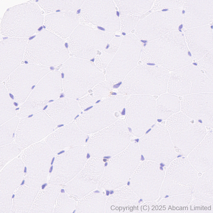Immunohistochemistry (Formalin/PFA-fixed paraffin-embedded sections) - Anti-LAIR1 antibody [EPR24745-9] (AB323640), expandable thumbnail