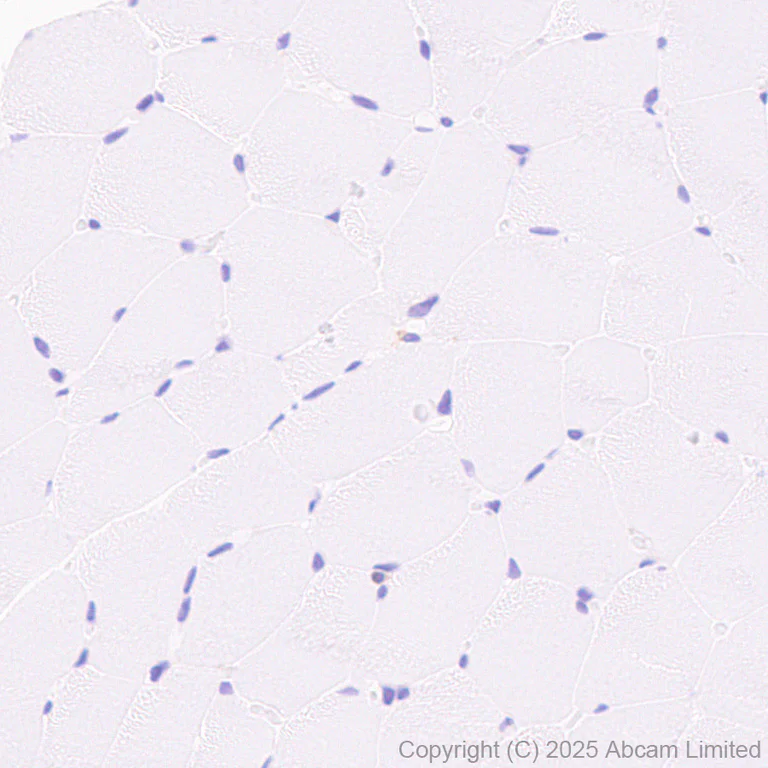 Immunohistochemistry (Formalin/PFA-fixed paraffin-embedded sections) - Anti-LAIR1 antibody [EPR24745-9] (AB323640)