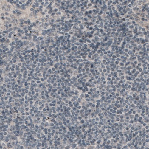Immunohistochemistry (Formalin/PFA-fixed paraffin-embedded sections) - Anti-LAMA1 antibody [CL3087] (AB210954), expandable thumbnail