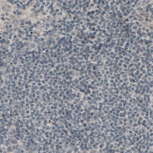 Immunohistochemistry (Formalin/PFA-fixed paraffin-embedded sections) - Anti-LAMA1 antibody [CL3087] (AB210954)