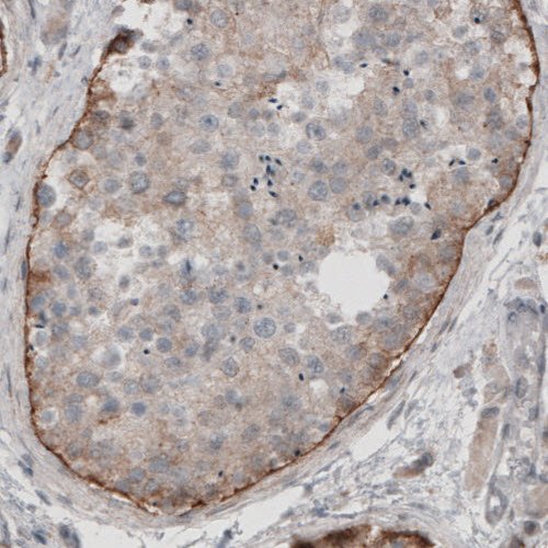 Immunohistochemistry (Formalin/PFA-fixed paraffin-embedded sections) - Anti-LAMA1 antibody [CL3087] (AB210954), expandable thumbnail