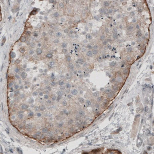Immunohistochemistry (Formalin/PFA-fixed paraffin-embedded sections) - Anti-LAMA1 antibody [CL3087] (AB210954)