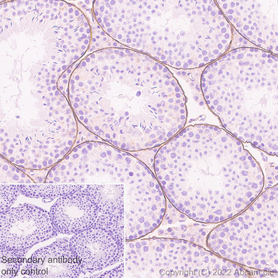 Immunohistochemistry (Formalin/PFA-fixed paraffin-embedded sections) - Anti-LAMA1 antibody [EPR27258-37] (AB307542), expandable thumbnail