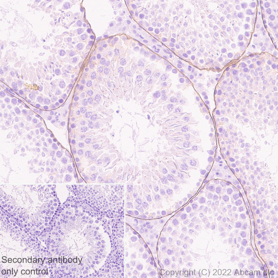Immunohistochemistry (Formalin/PFA-fixed paraffin-embedded sections) - Anti-LAMA1 antibody [EPR27258-37] (AB307542), expandable thumbnail