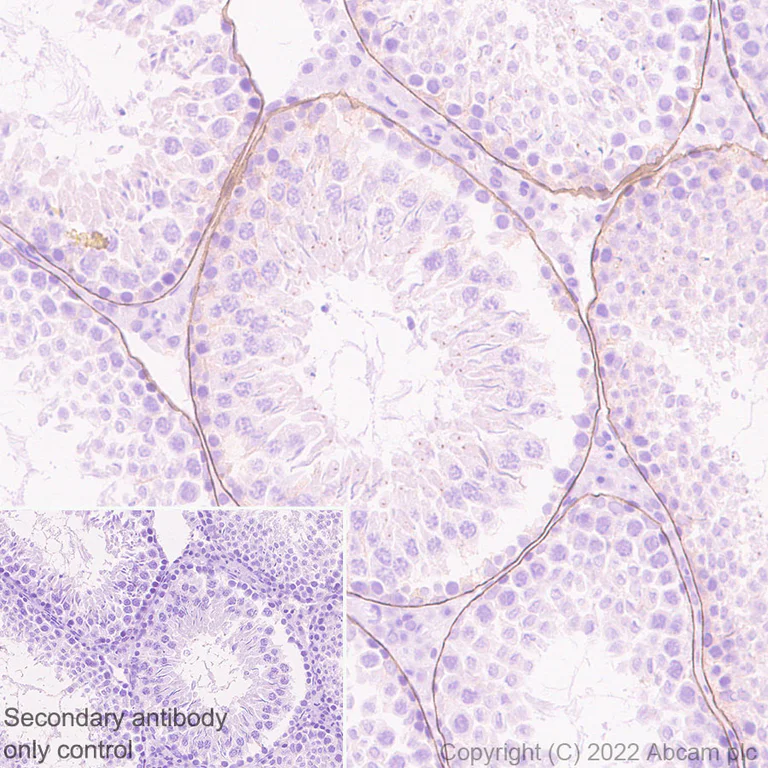 Immunohistochemistry (Formalin/PFA-fixed paraffin-embedded sections) - Anti-LAMA1 antibody [EPR27258-37] - BSA and Azide free (AB307543)