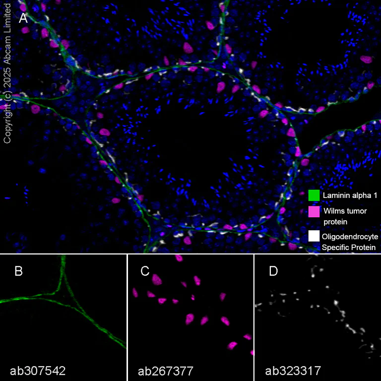 Multiplex immunohistochemistry - Anti-LAMA1 antibody [EPR27258-37] - BSA and Azide free (AB307543)