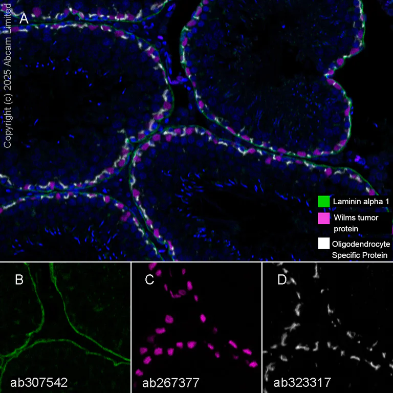 Multiplex immunohistochemistry - Anti-LAMA1 antibody [EPR27258-37] - BSA and Azide free (AB307543)