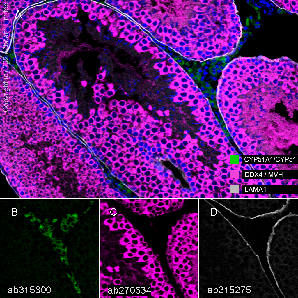 Anti-LAMA1 antibody [EPR27259-172] KO Tested (ab315275) | Abcam