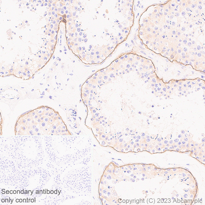 Immunohistochemistry (Formalin/PFA-fixed paraffin-embedded sections) - Anti-LAMA1 antibody [EPR27259-172] - BSA and Azide free (AB315276)