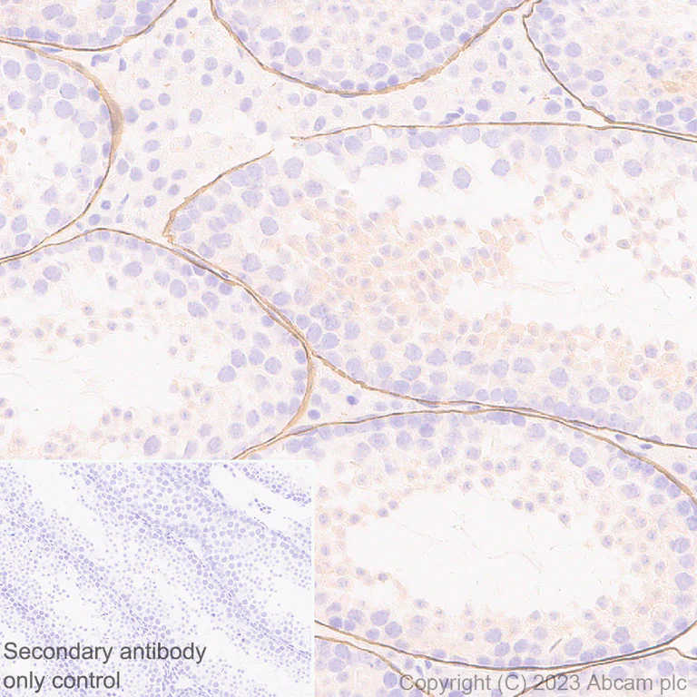 Immunohistochemistry (Formalin/PFA-fixed paraffin-embedded sections) - Anti-LAMA1 antibody [EPR27259-172] - BSA and Azide free (AB315276)