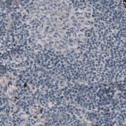 Immunohistochemistry (Formalin/PFA-fixed paraffin-embedded sections) - Anti-LAMA3 antibody [CL3112] (AB242197), expandable thumbnail